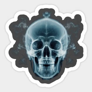 X-ray skull Sticker